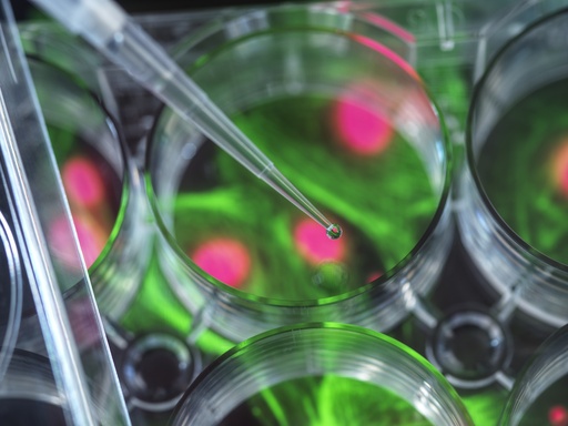 [SA-CAS9-114] Thyroid Stimulating Hormone (TSH) Receptor Cell Line
